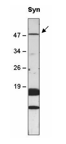 western blot using anti-sll0528 antibodies